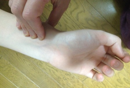 橈骨動脈で脈をとる